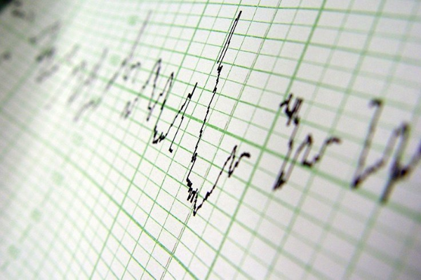 Cardiovascular clinical trials expertise CRO