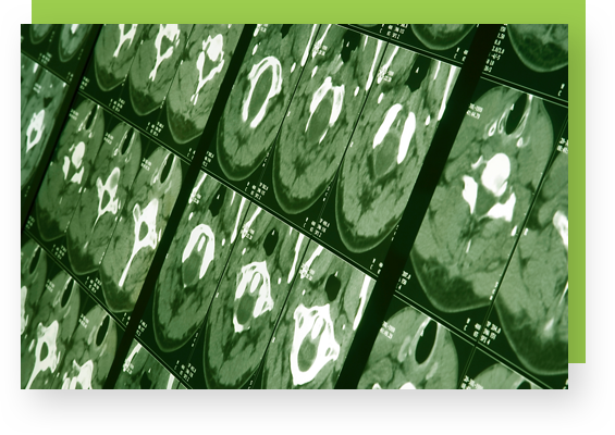 veristat-therapeutic-expertise-neurology.png veristat-therapeutic-expertise-neurology.png