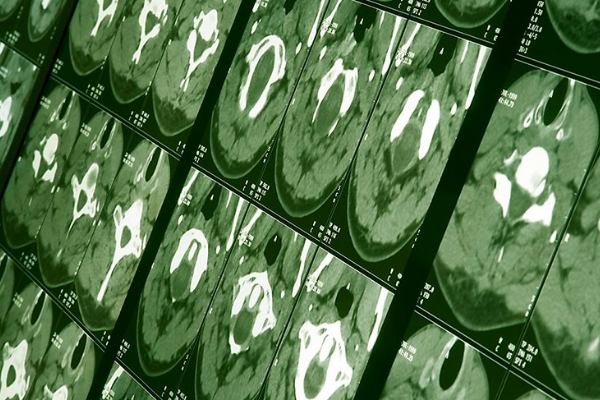 neurology_600x400